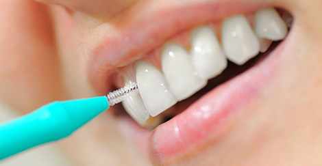 La higiene interdental es sinónimo de salud y bienestar